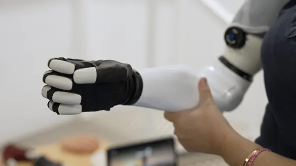 Bionic Prosthetics with AI Integration: Revolutionizing Mobility and Independence